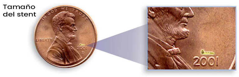 Size comparison of stent used for glaucoma surgery; smaller than the year stamped on US penny